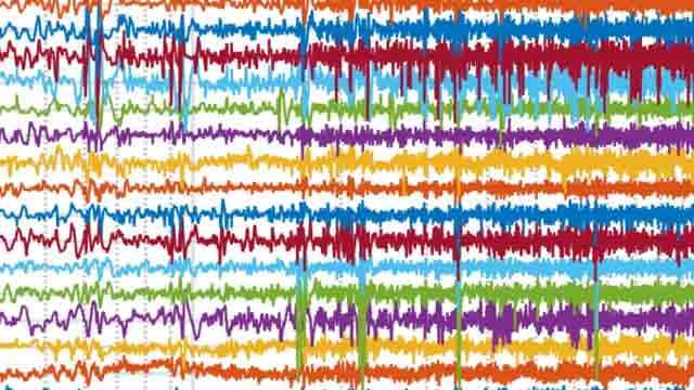 Vorhersage von epileptischen Anfällen anhand von EEG-Daten mittels Machine Learning 