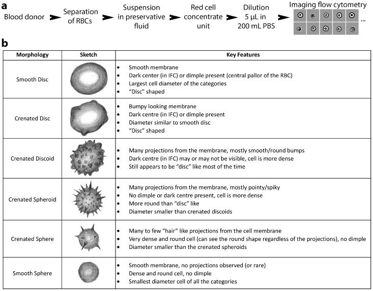 Figure 7. RBC morphologies.