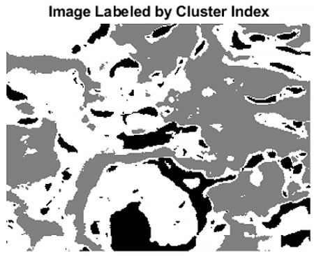Bild eines mithilfe von Cluster-Analyse in Baumklassen segmentierten Gewebes.
