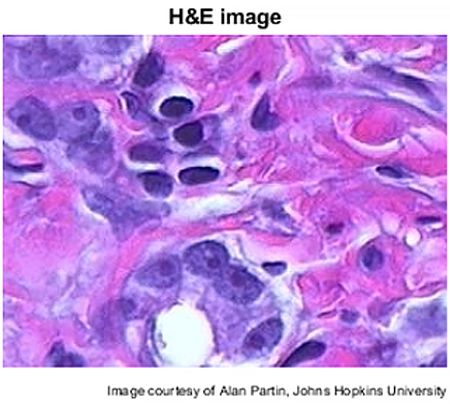 Bild eines mit Hämatoxylin und Eosin eingefärbten Gewebes.