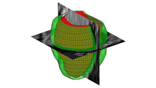 3D-Bildverarbeitung