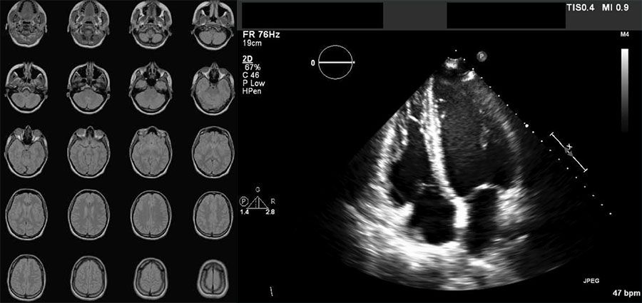 Beispiele für DICOM-formatierte Bilder: eine Serie von 20 Bildern aus MRT-Aufnahmen eines Gehirns und ein kardiales Ultraschallbild.