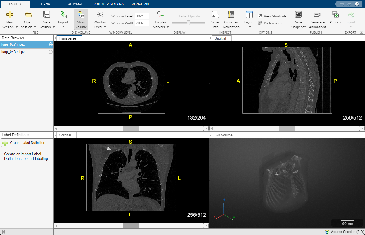 Screenshot mit transversalen, sagittalen, koronalen und 3D-Volumen-DICOM-Bilder einer Thorax-CT-Aufnahme mit Beschriftungen.