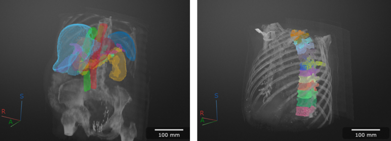 Eine medizinische KI-Anwendung zeigt die Segmentierung und Beschriftung innerer Organe in 3D-Scans eines Torsos.