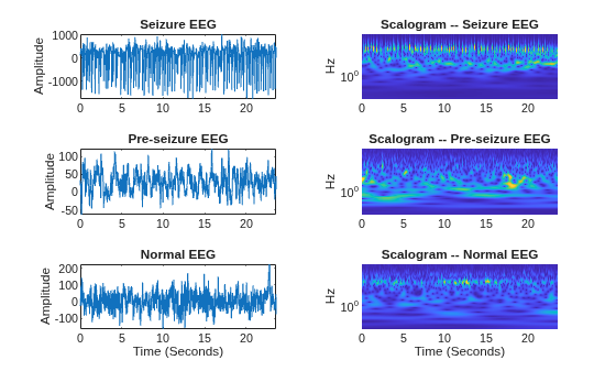 Time-Frequency Convolutional Network for EEG Data Classification