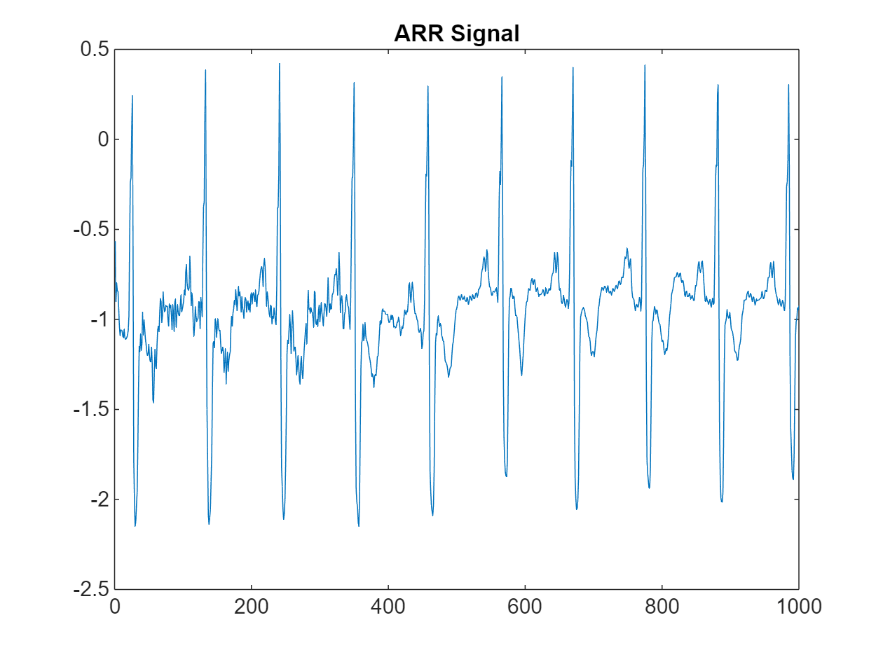 Deploy Signal Classifier Using Wavelets and Deep Learning on Raspberry Pi