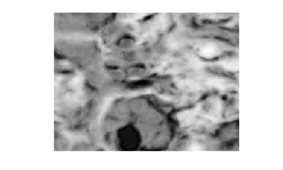 Figure contains an axes object. The hidden axes object contains an object of type image.