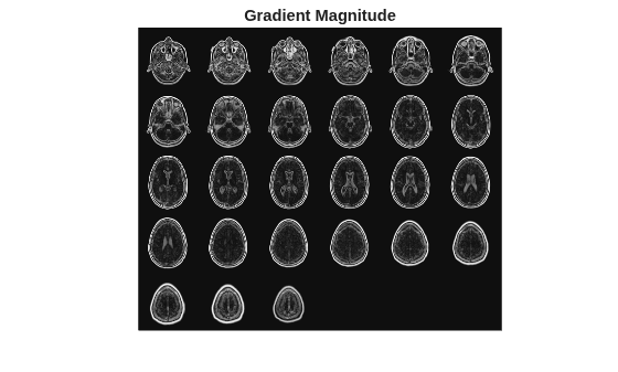Figure contains an axes object. The hidden axes object with title Gradient Magnitude contains an object of type image.