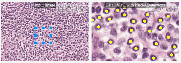 Detect and Count Cell Nuclei in Whole Slide Images