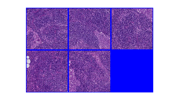 Figure contains an axes object. The hidden axes object contains an object of type image.