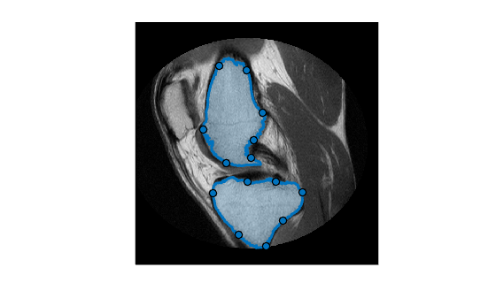 Figure contains an axes object. The hidden axes object contains 3 objects of type image, images.roi.freehand.