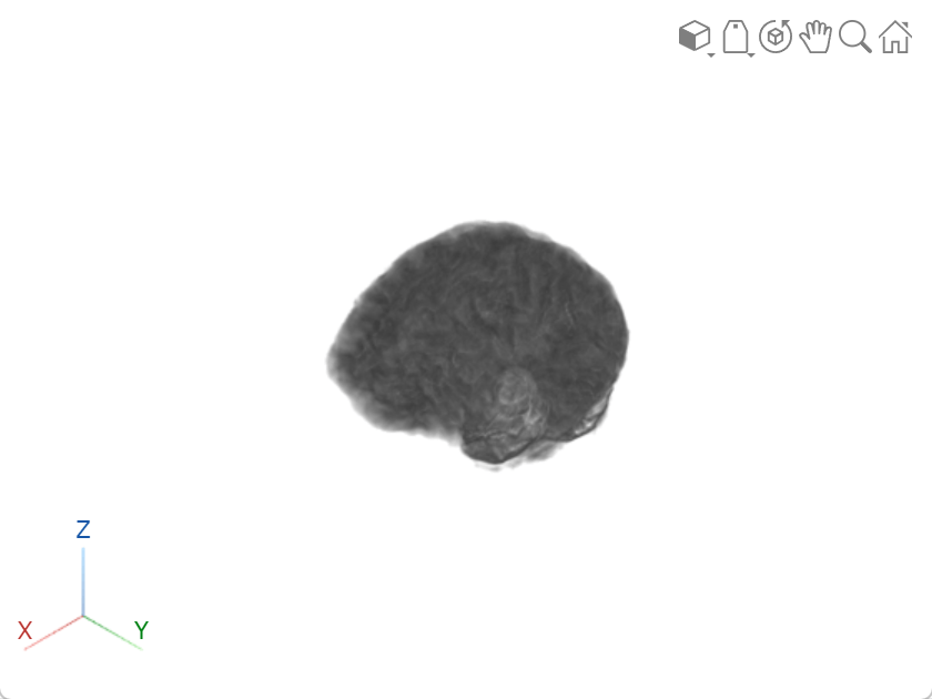 Brain volume displayed using the volshow function