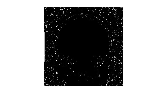 Figure contains an axes object. The hidden axes object contains an object of type image.