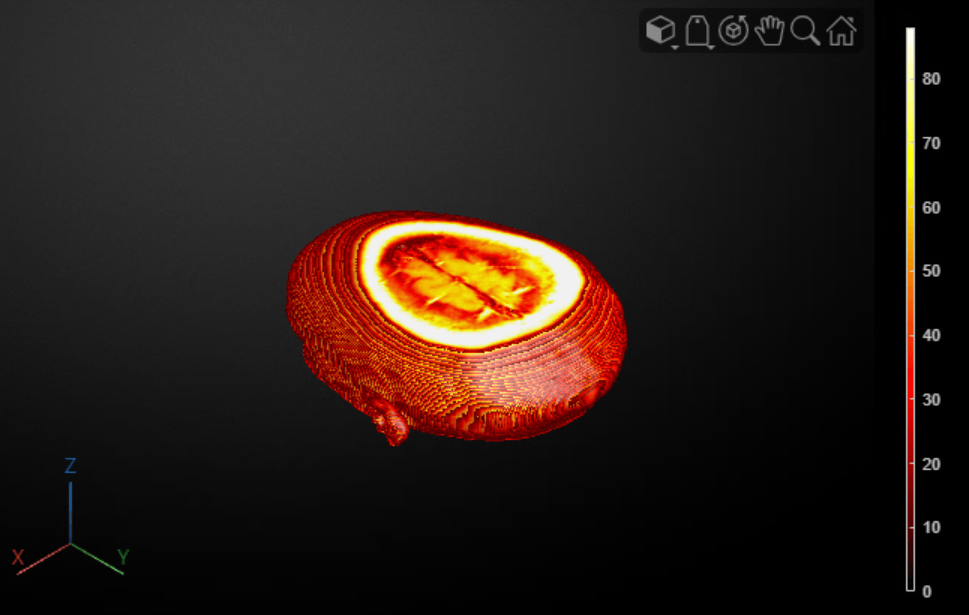 MRI volume rendered as an isosurface with hot colormap showing the skull structure