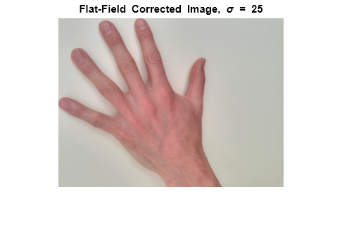 Figure contains an axes object. The hidden axes object with title Flat-Field blank Corrected blank Image, blank sigma blank = 25 contains an object of type image.