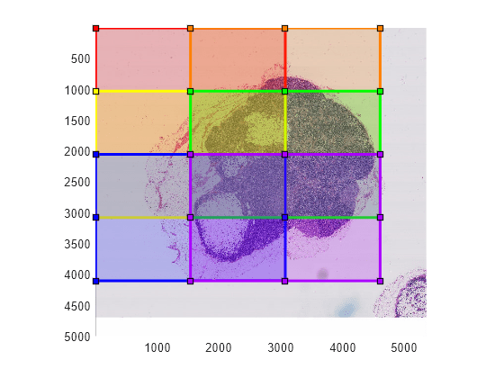 Figure contains an axes object. The axes object contains 7 objects of type bigimageshow, images.roi.rectangle.