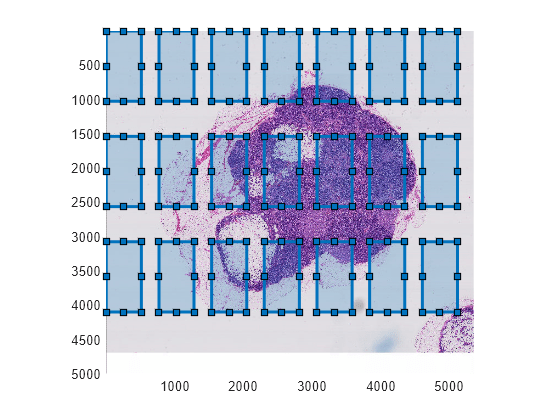 Figure contains an axes object. The axes object contains 22 objects of type bigimageshow, images.roi.rectangle.