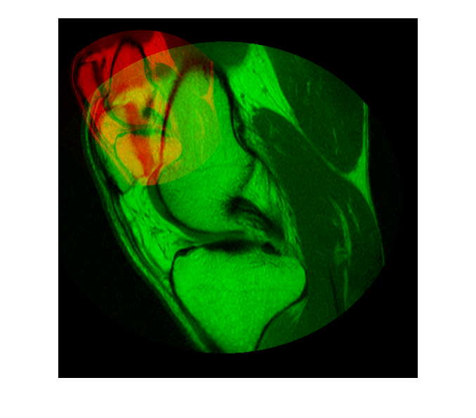 Figure contains an axes object. The hidden axes object contains an object of type image.