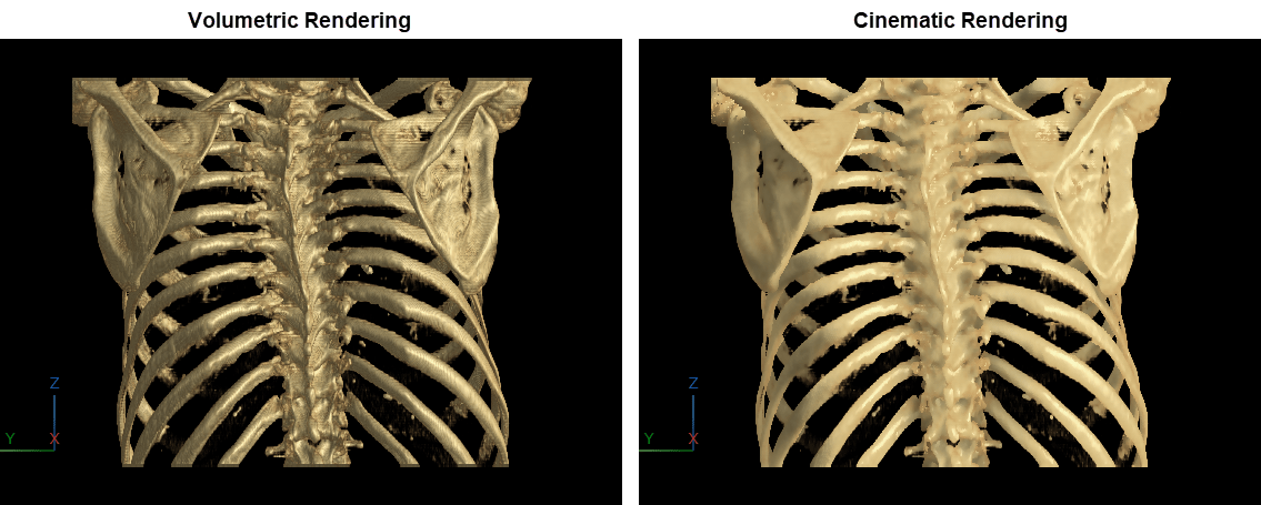 Side-by-side comparison of a chest CT scan displayed using standard volume rendering and cinematic rendering