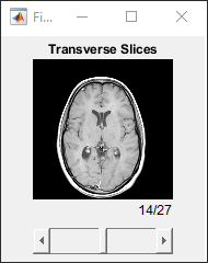 Slice viewer window showing axial slices scaled using the ScaleFactors name-value argument