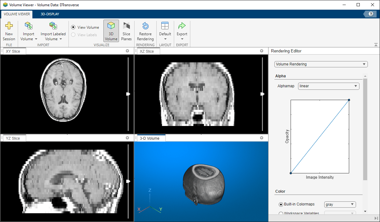 Volume Viewer app window showing the scaled MRI slices and 3-D volume