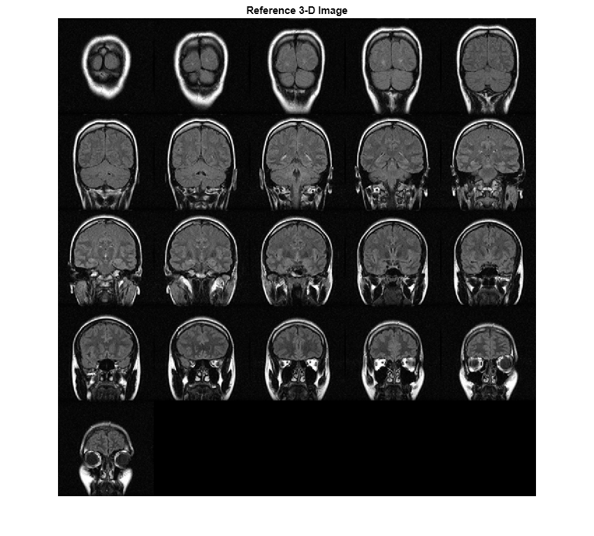 Figure contains an axes object. The hidden axes object with title Reference 3-D Image contains an object of type image.