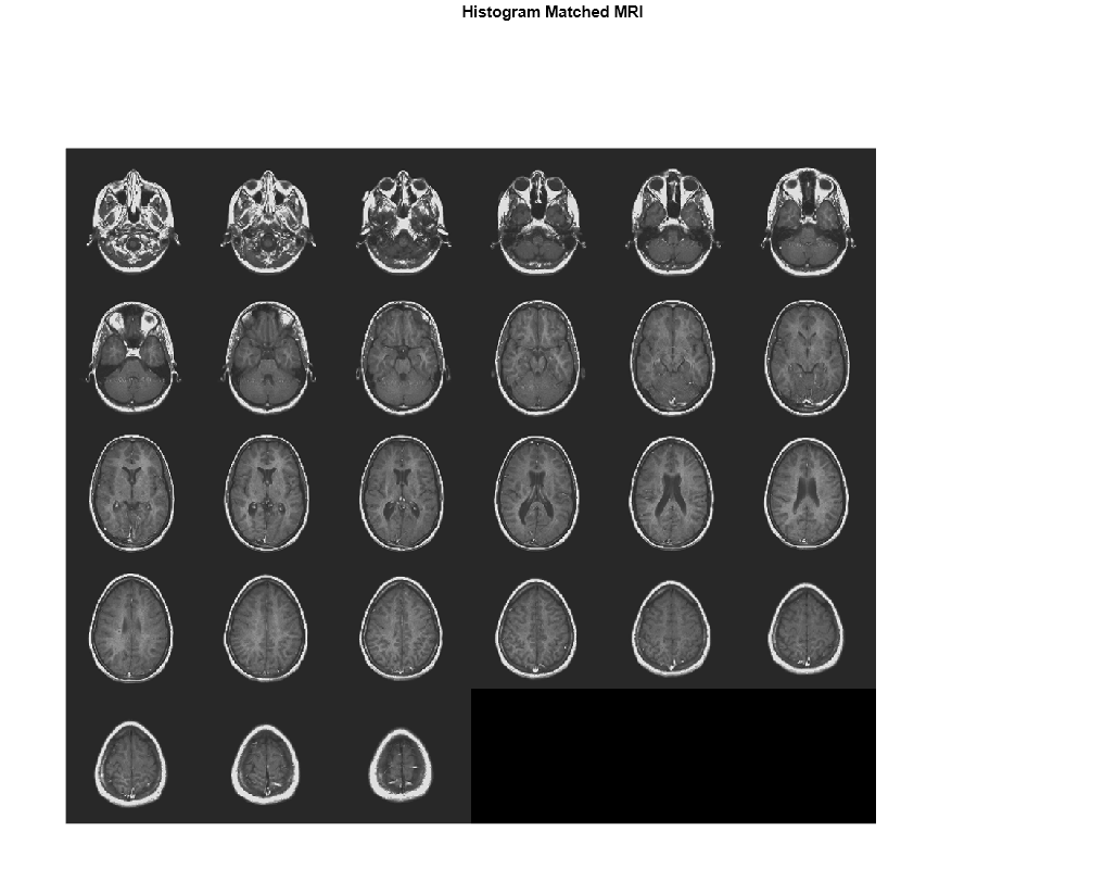 Figure contains an axes object. The hidden axes object with title Histogram Matched MRI contains an object of type image.