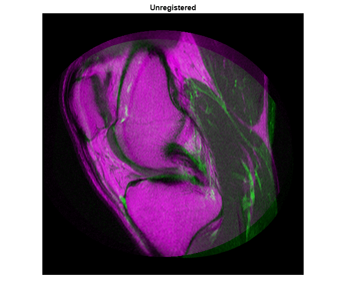 Figure contains an axes object. The hidden axes object with title Unregistered contains an object of type image.