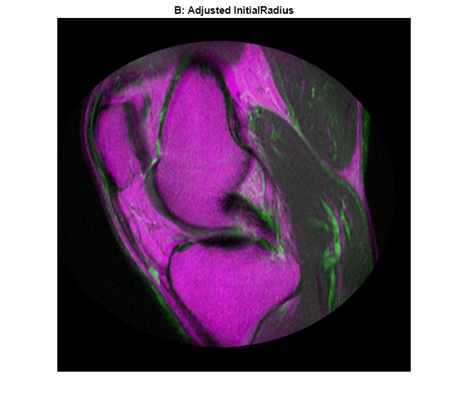 Figure contains an axes object. The hidden axes object with title B: Adjusted InitialRadius contains an object of type image.