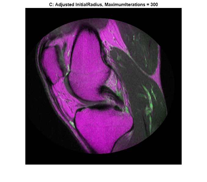 Figure contains an axes object. The hidden axes object with title C: Adjusted InitialRadius, MaximumIterations = 300 contains an object of type image.