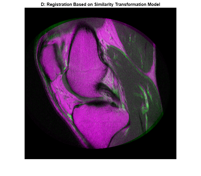 Figure contains an axes object. The hidden axes object with title D: Registration Based on Similarity Transformation Model contains an object of type image.