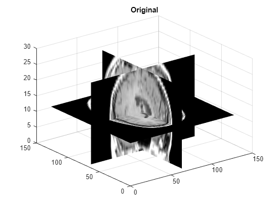 Download Resize 3-D volumetric intensity image - MATLAB imresize3 ...