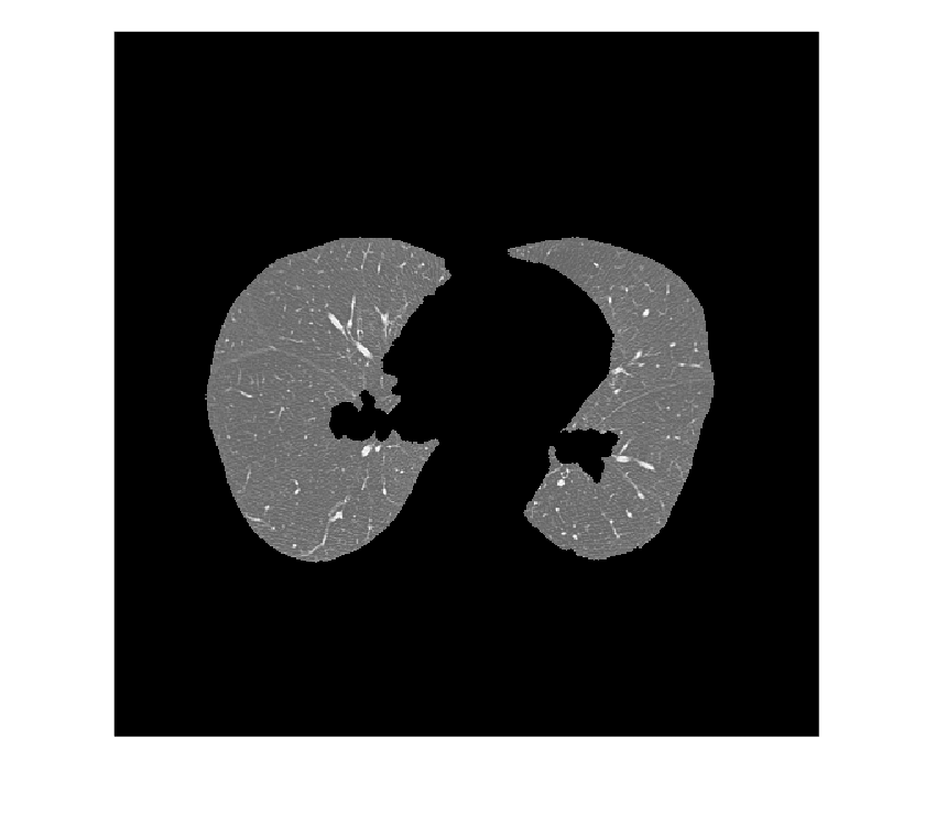 Figure contains an axes object. The hidden axes object contains an object of type image.