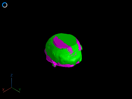 Register Multimodal 3-D Medical Images