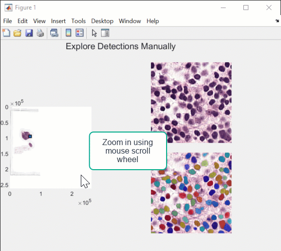 Animation showing how to use the interactive window to explore labels across the WSI