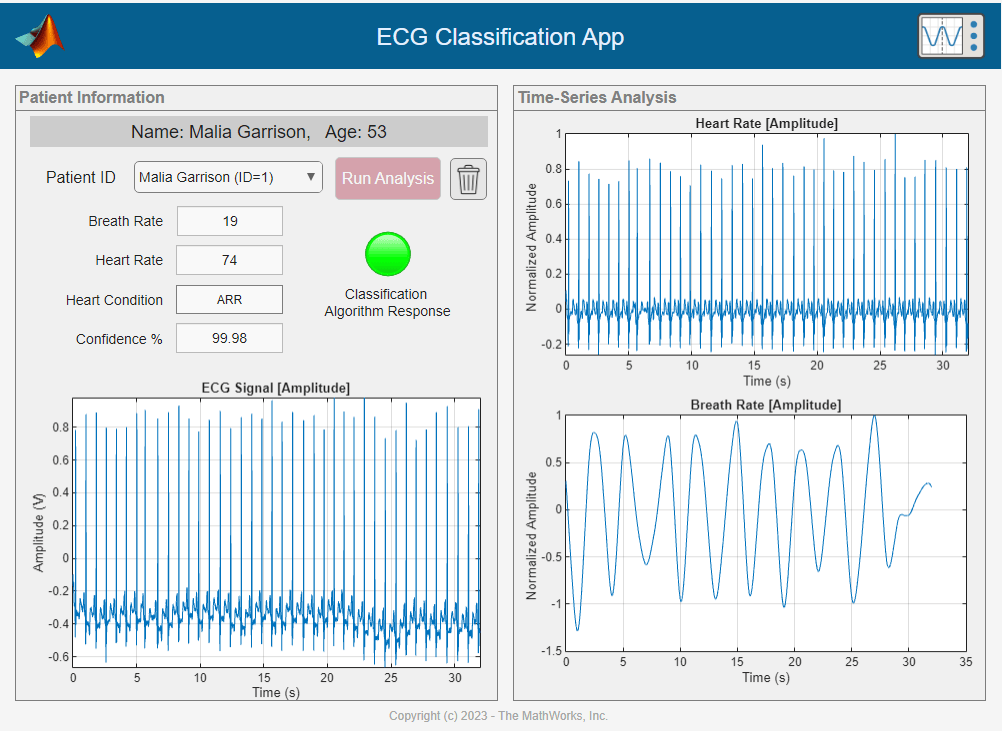 The ECG signal data for the first patient from the patient ID list