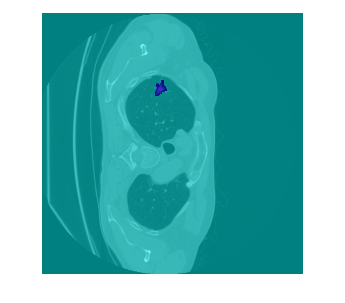 Figure contains an axes object. The axes object contains an object of type image.