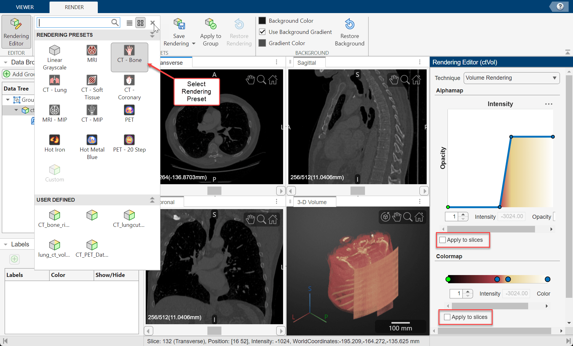 Apply a rendering preset to the 3-D display from the gallery, and optionally apply presets to 2-D slices from the Rendering Editor
