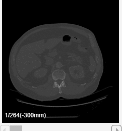 Animation of the 2-D transverse slices of the CT volume