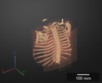 Animation of the 3-D volume rotating about the SI axis