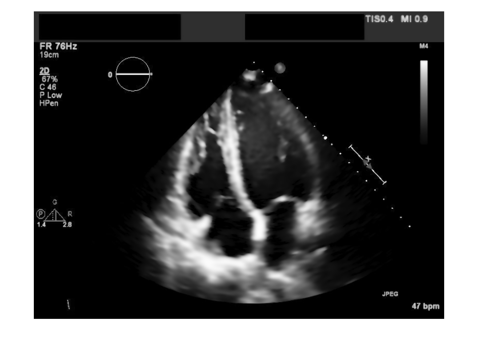 Read, Process, and View Ultrasound Data