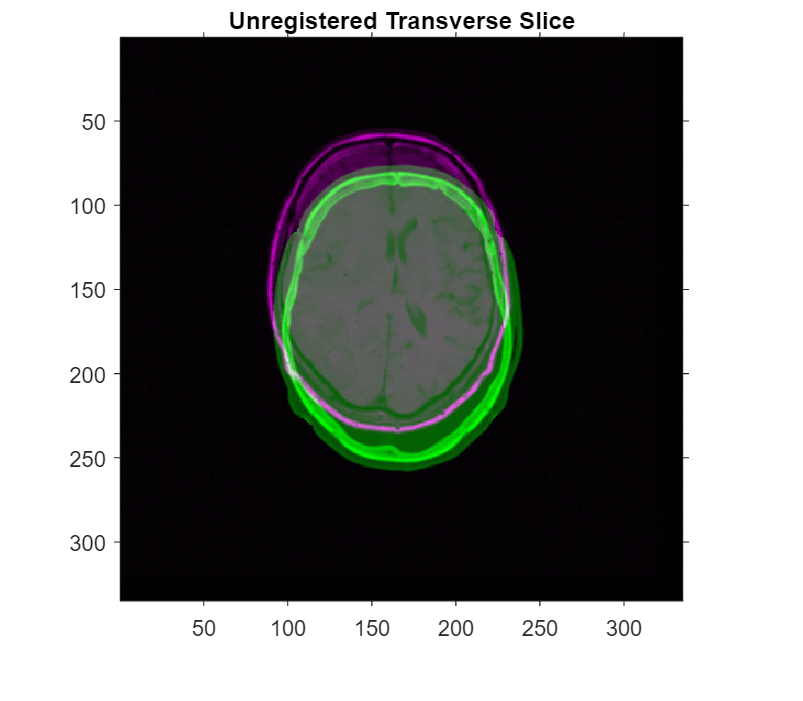 Register Multimodal Medical Image Volumes with Spatial Referencing