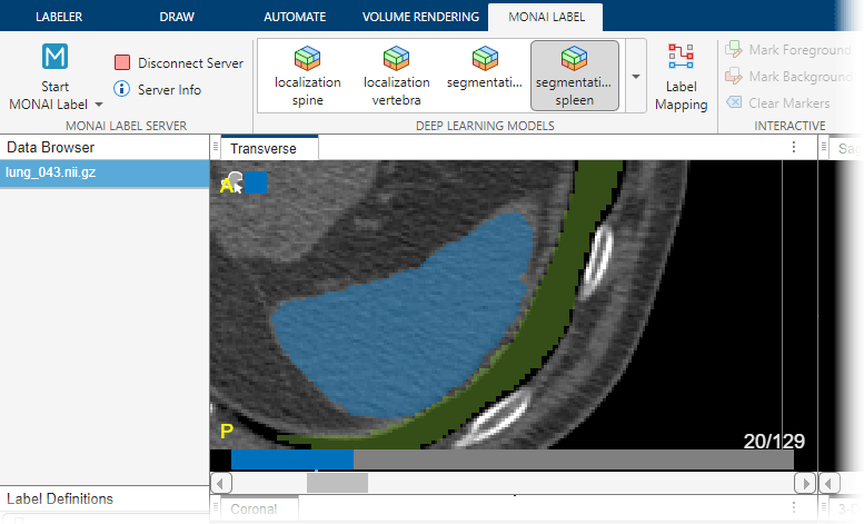 Medical Image Labeler window, showing the updated spleen label predicted by the segmentation spleen model