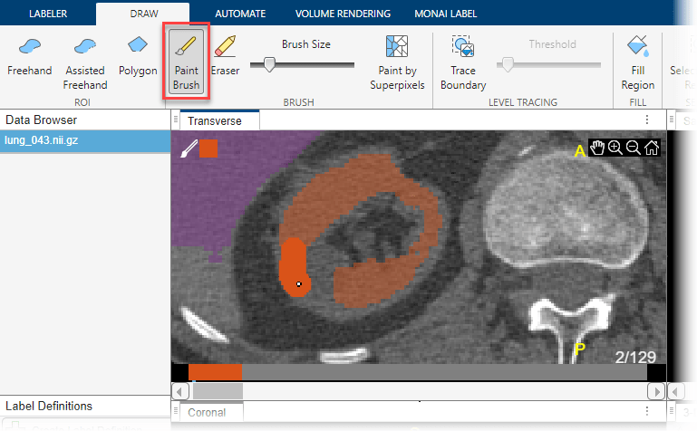 Manually refine the right kidney label by using the paintbrush tool in the Draw tab.
