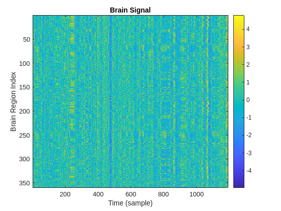 Figure contains an axes object. The axes object with title Brain Signal, xlabel Time (sample), ylabel Brain Region Index contains an object of type image.