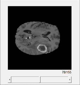 Cross-section of volumetric data displayed in a figure window, with a scrollbar to change the slice