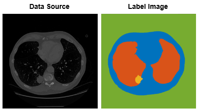 Data source and label image for a 2-D chest CT slice