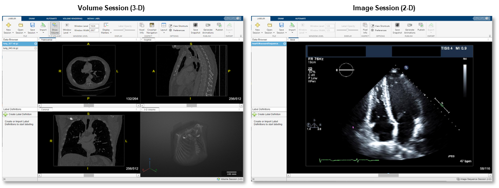 Side-by-side view of Medical Image Labeler app Volume session and Image session