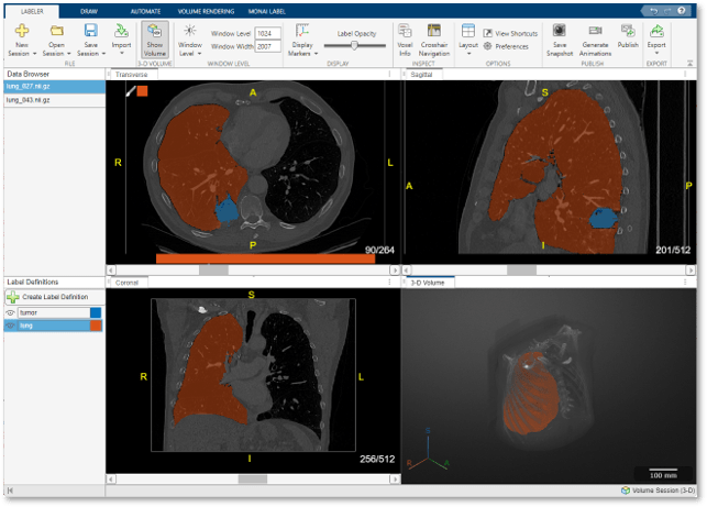 Snapshot of the Medical Image Labeler app that shows a CT chest volume with lung and tumor labels in 3-D