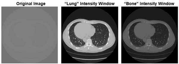 Original transverse CT lung slice image, and slice with intensity windowing applied using lung and bone windows
